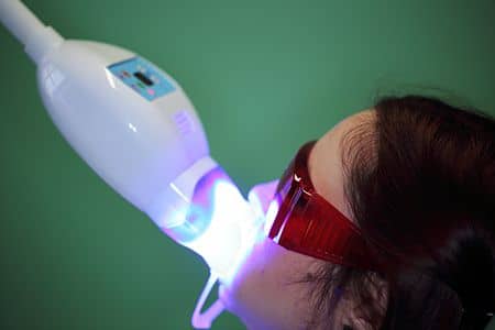 Teeth Whitening using Zoom / Beyond / Advanced Whitening type UV Lamp